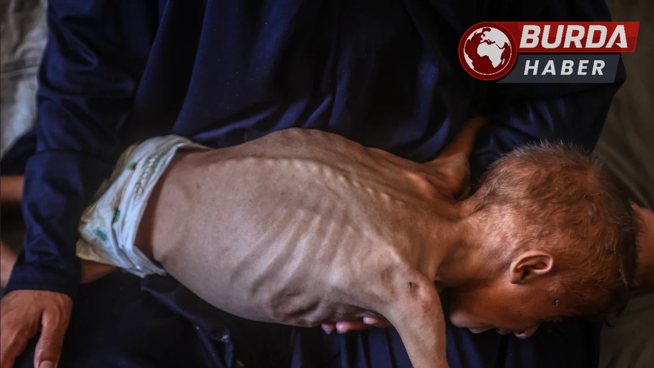 Gazze’de son 24 saatte 3 kişi daha açlıktan öldü.