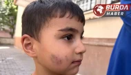 Ankara'da evde uyuyan çocuğu lağım faresi ısırdı.