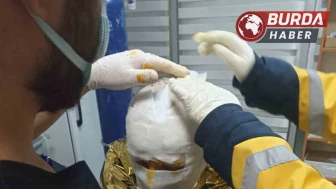 Erzincan'da Kömür Madeninde Meydana Gelen Yangında 2 İşçi Yaralandı