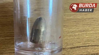 Bahçede oynayan 8 yaşındaki çocuğa yorgun mermi isabet etti.