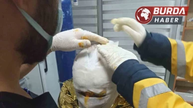 Erzincan'da Kömür Madeninde Meydana Gelen Yangında 2 İşçi Yaralandı