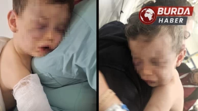 İki yaşındaki Aren bebeği hastanelik eden caniler gözaltına alındı.