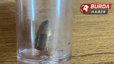Bahçede oynayan 8 yaşındaki çocuğa yorgun mermi isabet etti.