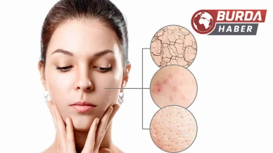 Uzmanı uyardı: Baharda cilt hastalıklarında artış oluyor