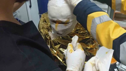 Erzincan'da Kömür Madeninde Meydana Gelen Yangında 2 İşçi Yaralandı