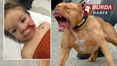 Ankara'da Çocukları Yaralayan Köpeğin Sahibi Tutuklandı.