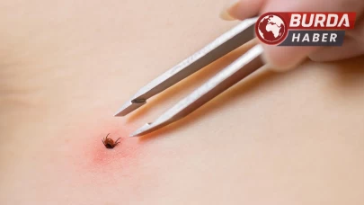 Halsizlik nedeniyle hastanede karnına yapışan kene bulundu.