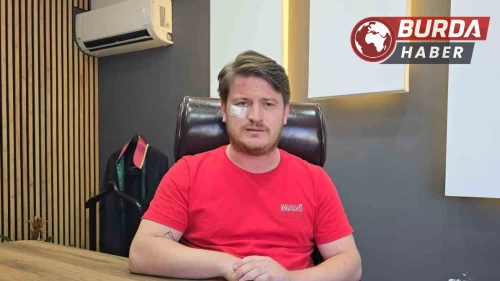 Meslektaşının ofisinde saldırıya uğrayan avukat yaşananları anlattı.