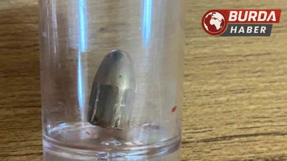 Bahçede oynayan 8 yaşındaki çocuğa yorgun mermi isabet etti.