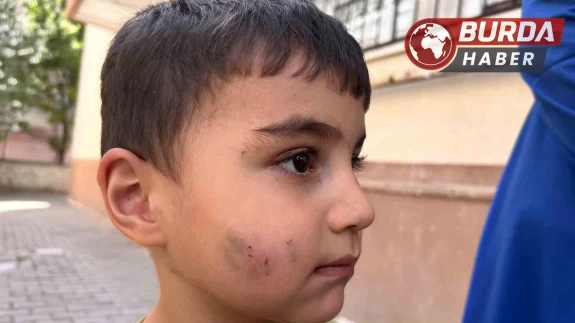 Ankara'da evde uyuyan çocuğu lağım faresi ısırdı.