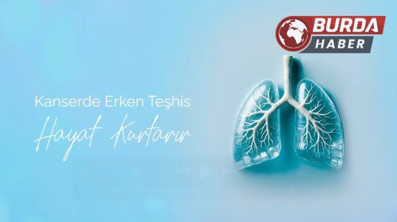 Akciğer Kanserinde Erken Teşhis Hayat Kurtarıcı Olabilir