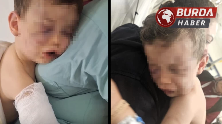 İki yaşındaki Aren bebeği hastanelik eden caniler gözaltına alındı.