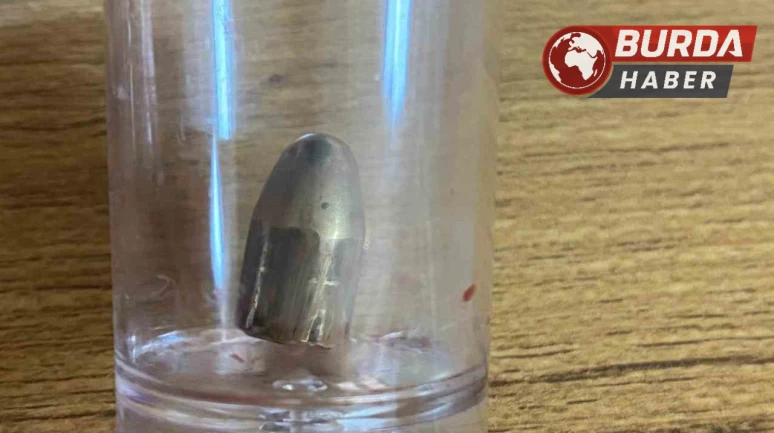 Bahçede oynayan 8 yaşındaki çocuğa yorgun mermi isabet etti.