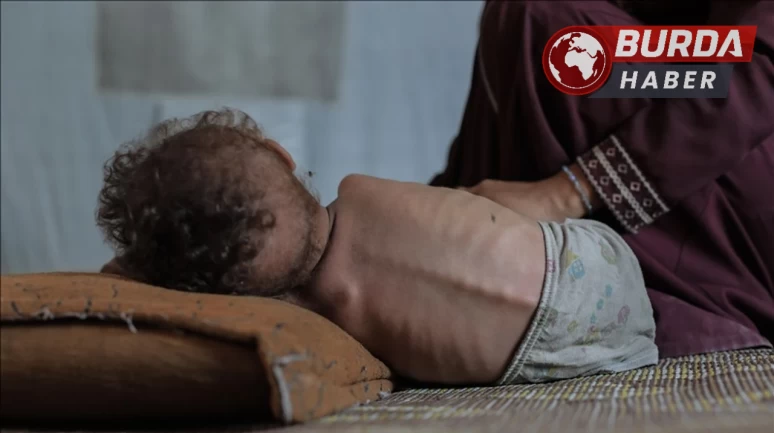 Gazze Şeridi’nde 2’si çocuk 5 sivil daha açlıktan hayatını kaybetti.