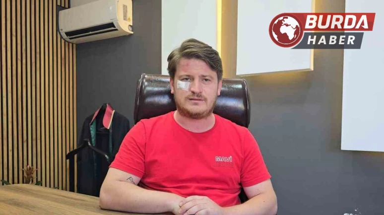 Meslektaşının ofisinde saldırıya uğrayan avukat yaşananları anlattı.