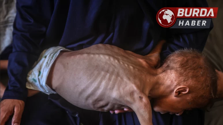 Gazze’de son 24 saatte 3 kişi daha açlıktan öldü.
