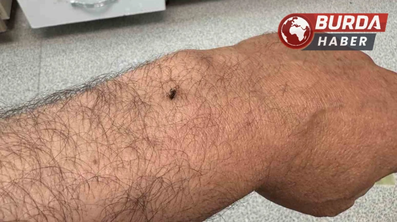 Karaman'da itfaiye erinin koluna yapışan kene hastanede çıkarıldı